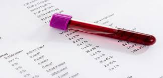 Tubo de muestra sanguínea sobre informe de hemograma